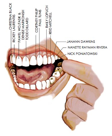 teeth.jpg