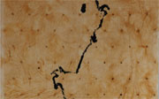 Post image for Help Fight Leukemia: Art Benefit and Silent Auction At Jen Bekman Gallery Tomorrow